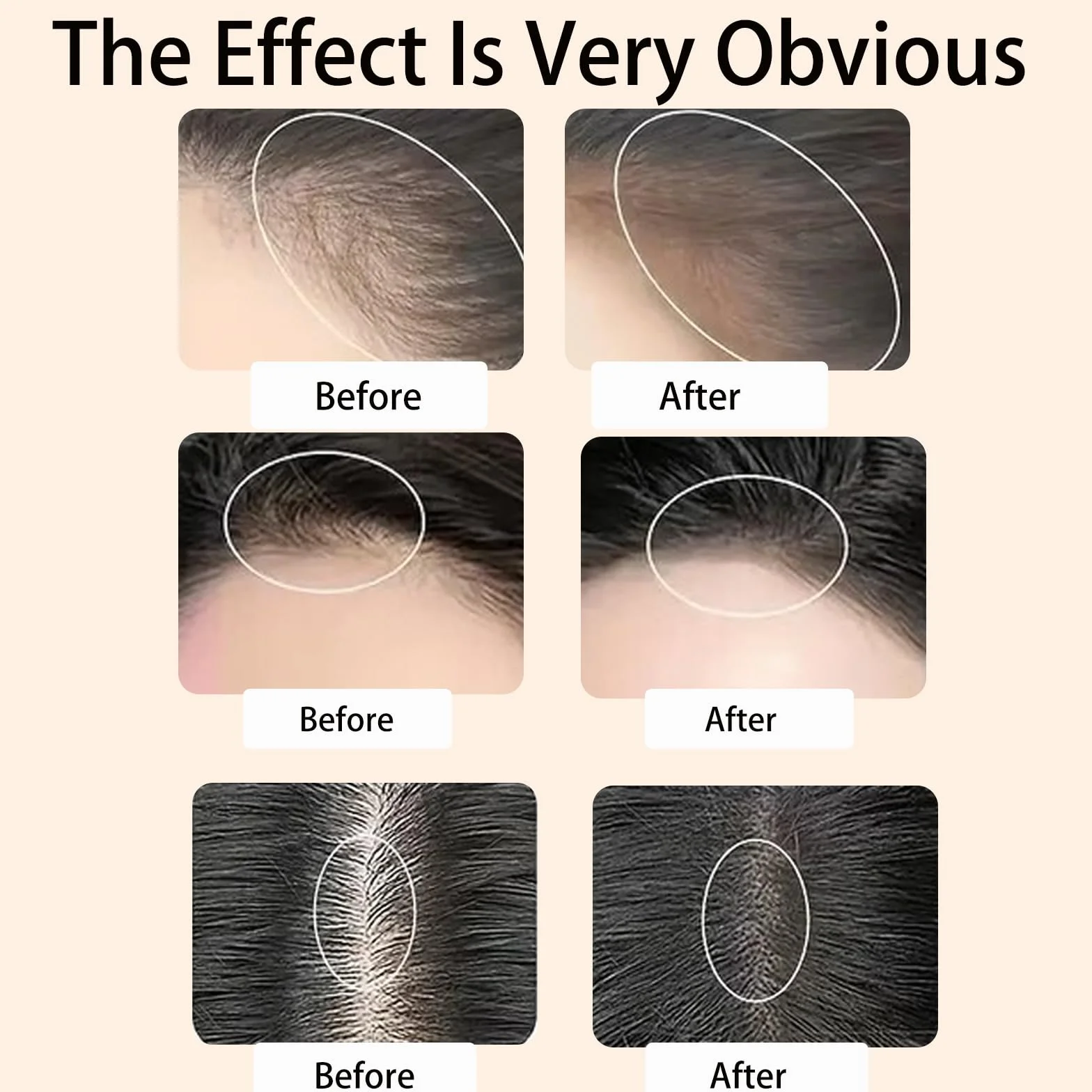Hairline Powder,Natychmiastowa linia włosów w proszku,proszek z korzeni włosów,pokrywa korzeniowa,linia włosów,do wypełniania rozjaśnionych włosów,korektor korzeni włosów do makijażu dla(czarny)
