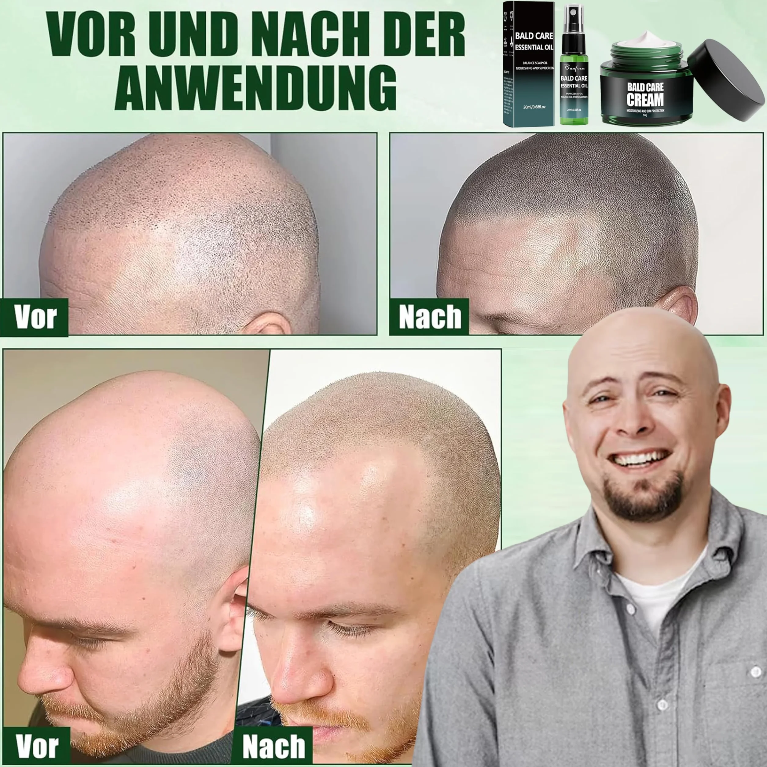Pielęgnujący krem na łysinę i spray do pielęgnacji skóry głowy - zestaw, krem do pielęgnacji skóry głowy, pielęgnujący spray dla łysych, nawilżająca pielęgnacja łysej głowy, odświeżający i