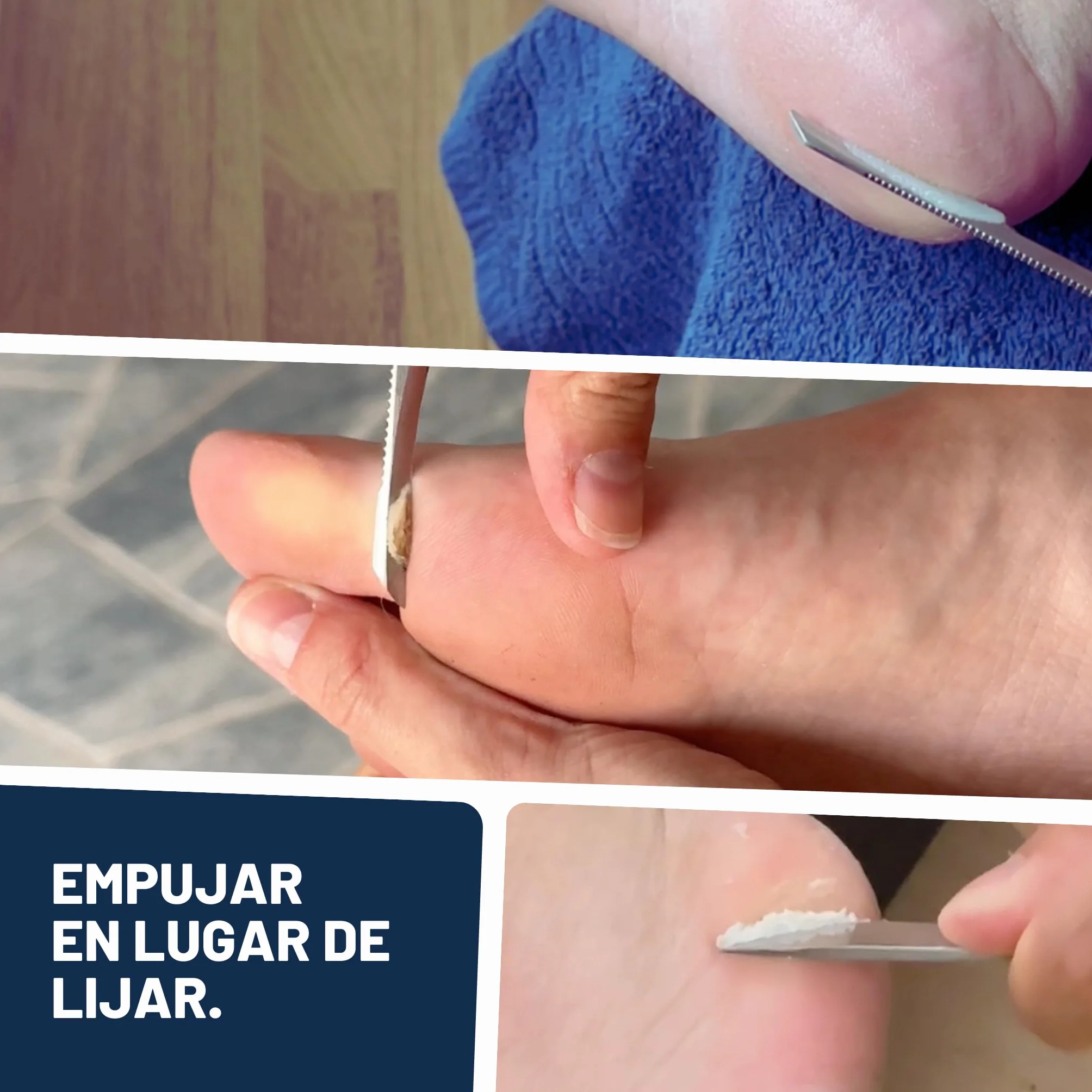 Mr. Fuss Callus Remover roztwór nr 4 500 ml do stóp – płynny środek do usuwania zrogowaciałego naskórka i skórek z natychmiastowym działaniem, do delikatnej pielęgnacji stóp i dłoni