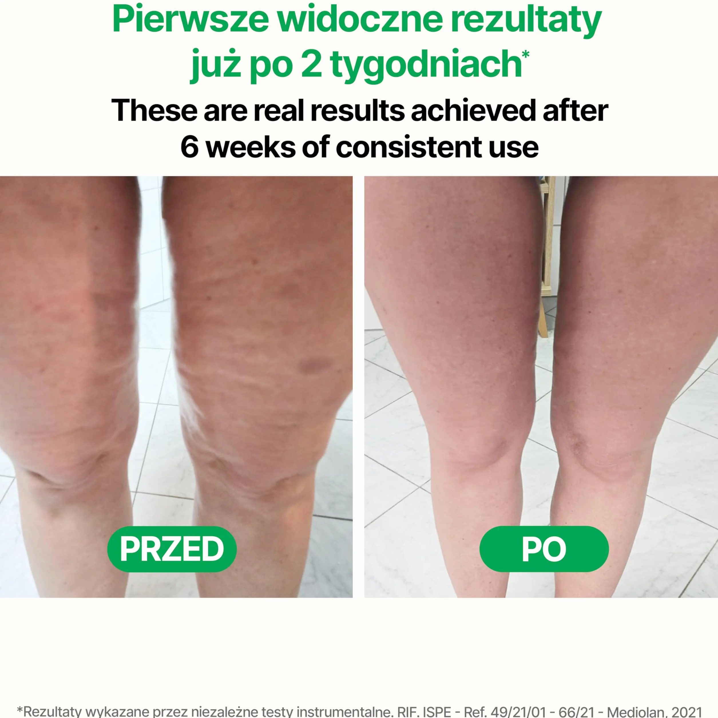 TESMED CELLULITE Ręczny opatentowany masażer antycellulitowy – masażer antycellulitowy i urządzenie ujędrniające skórę na nogi, pośladki i uda – Wyprodukowano we Włoszech