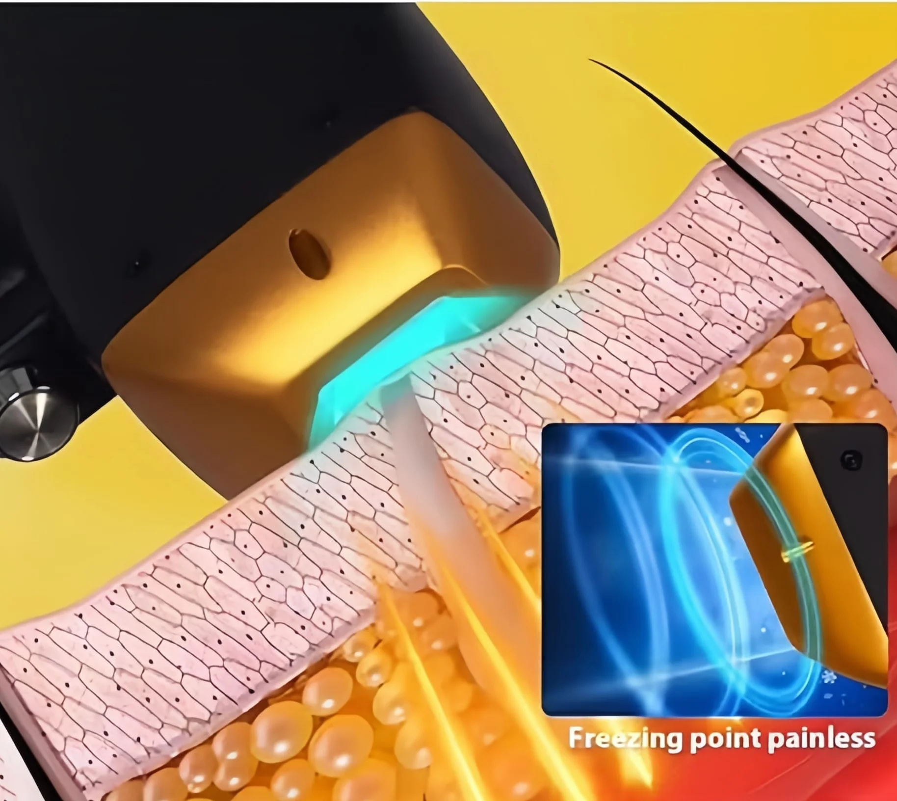 Chłodzenie lodu o wysokiej mocy 3000W 755 808 1064nm 3 urządzenia o długości fali Dioda Laser Epilator 808nm Maszyna do depilacji