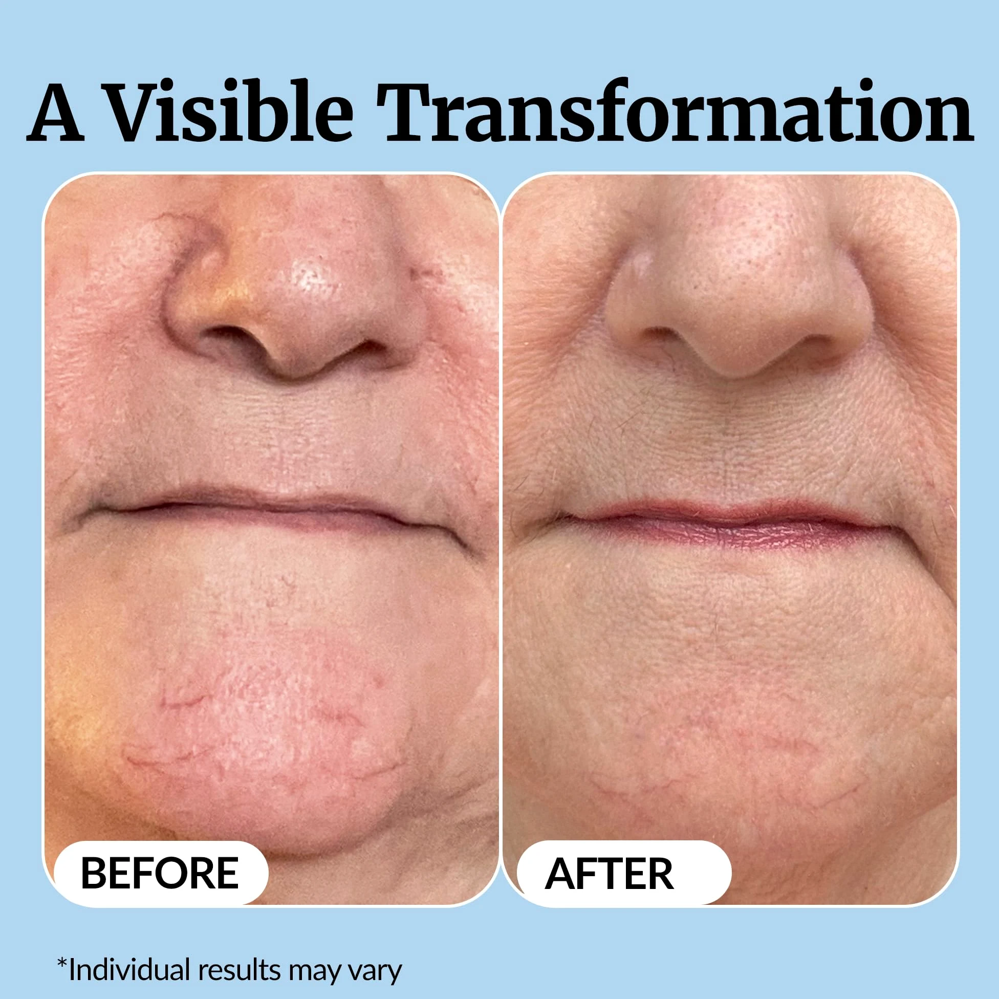 Vibriance Super C serum do skóry dojrzałej, wyprodukowane w USA, formuła All-In-One Hydrates, Firms, Lifts, Targets Age Spots, Wrinkles, & Smooths Skin, The Original Super C Serum - 30 ml (30 ml),
