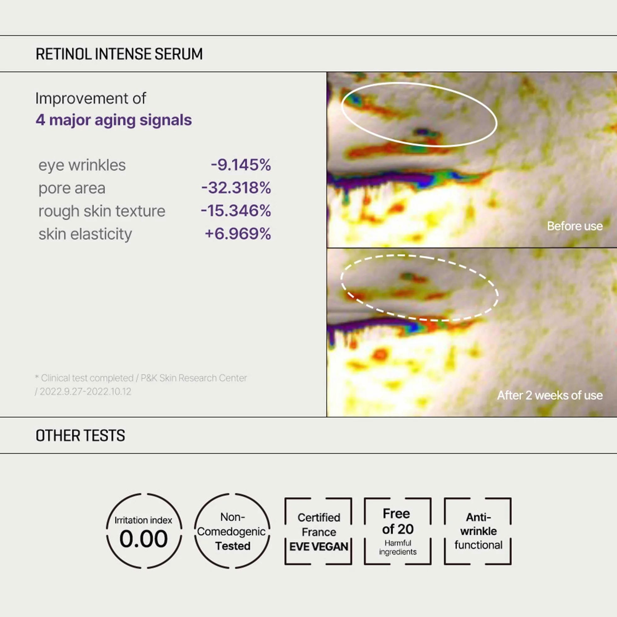 Some by Mi Retinol Intense Trial Kit
