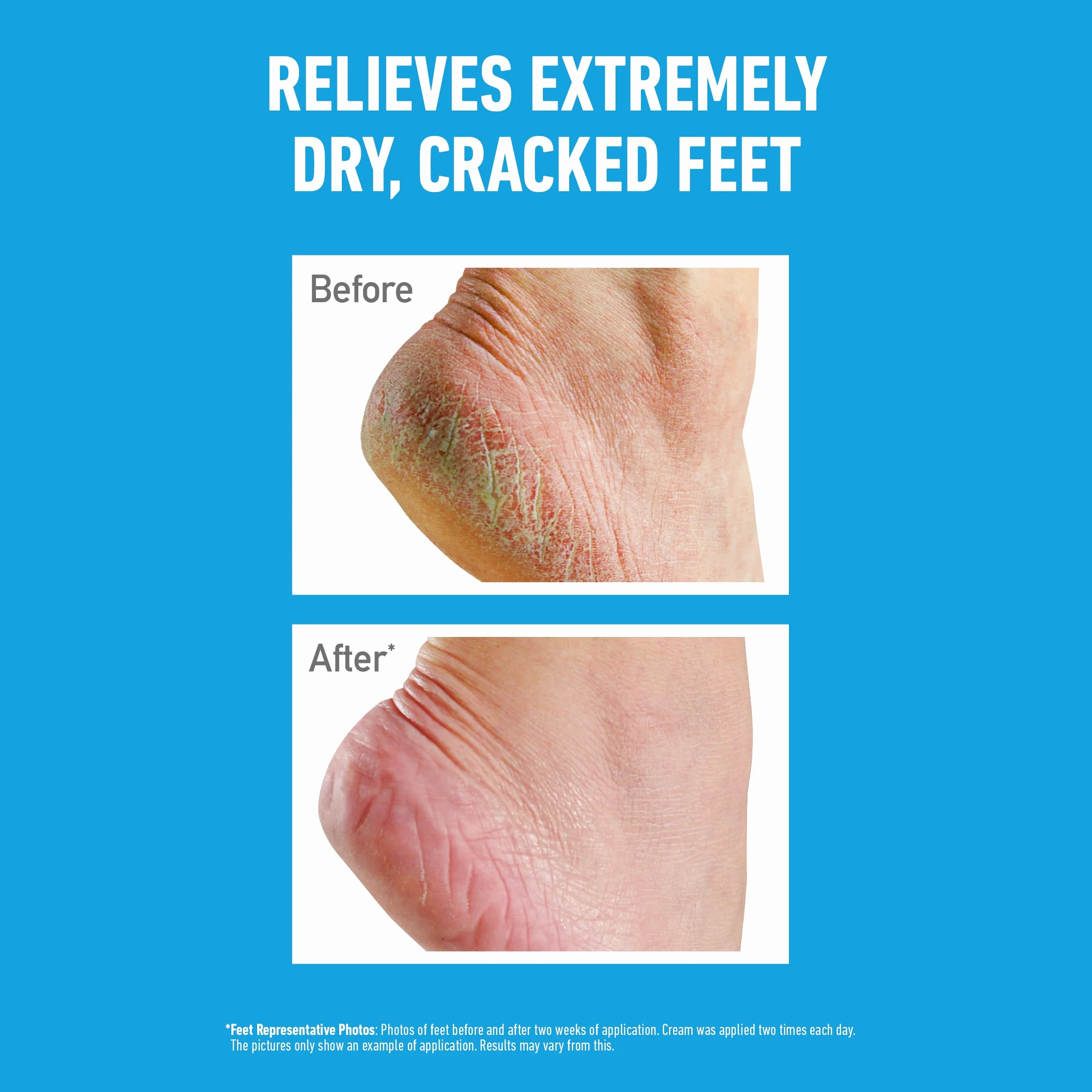 O'Keeffe's Healthy Feet krem do stóp w tubce, 80 ml - 2 sztuki