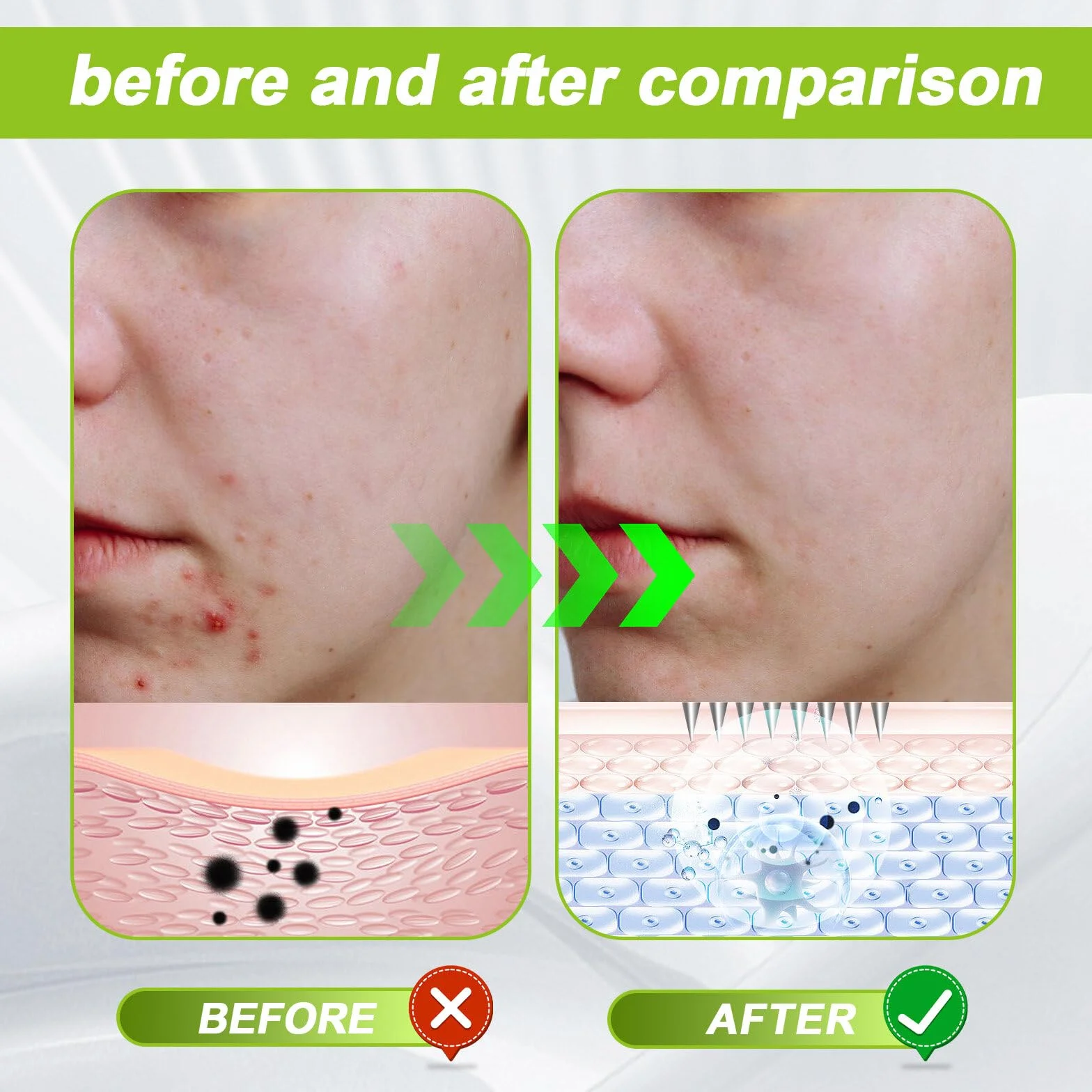 Derma Stamp Microneedling: regulowany mikroigłowany dermastamp z 140 tytanowymi pinami, profesjonalny mikroigłowany dermapen do włosów, derma stempel do twarzy, ciała, włosów, zarostu w domu