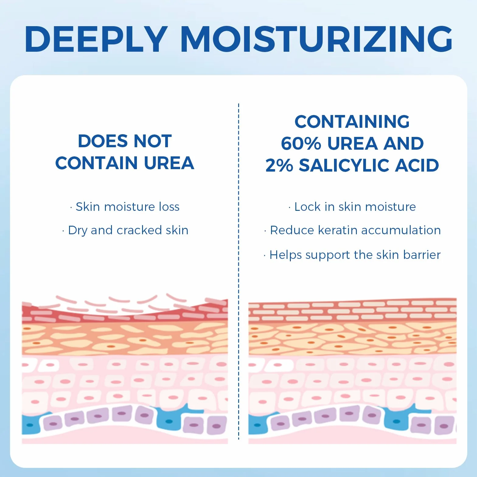 OUKEYA Urea Crème 60% plus Salicylzuur 2% & Vitamine E, Intensieve Nederlandse Crème voor Droge & Gebarsten Huid aan Voeten, Ellebogen en Handen, Verwijdering van Eelt & Dode Huid, Antioxidant Werking