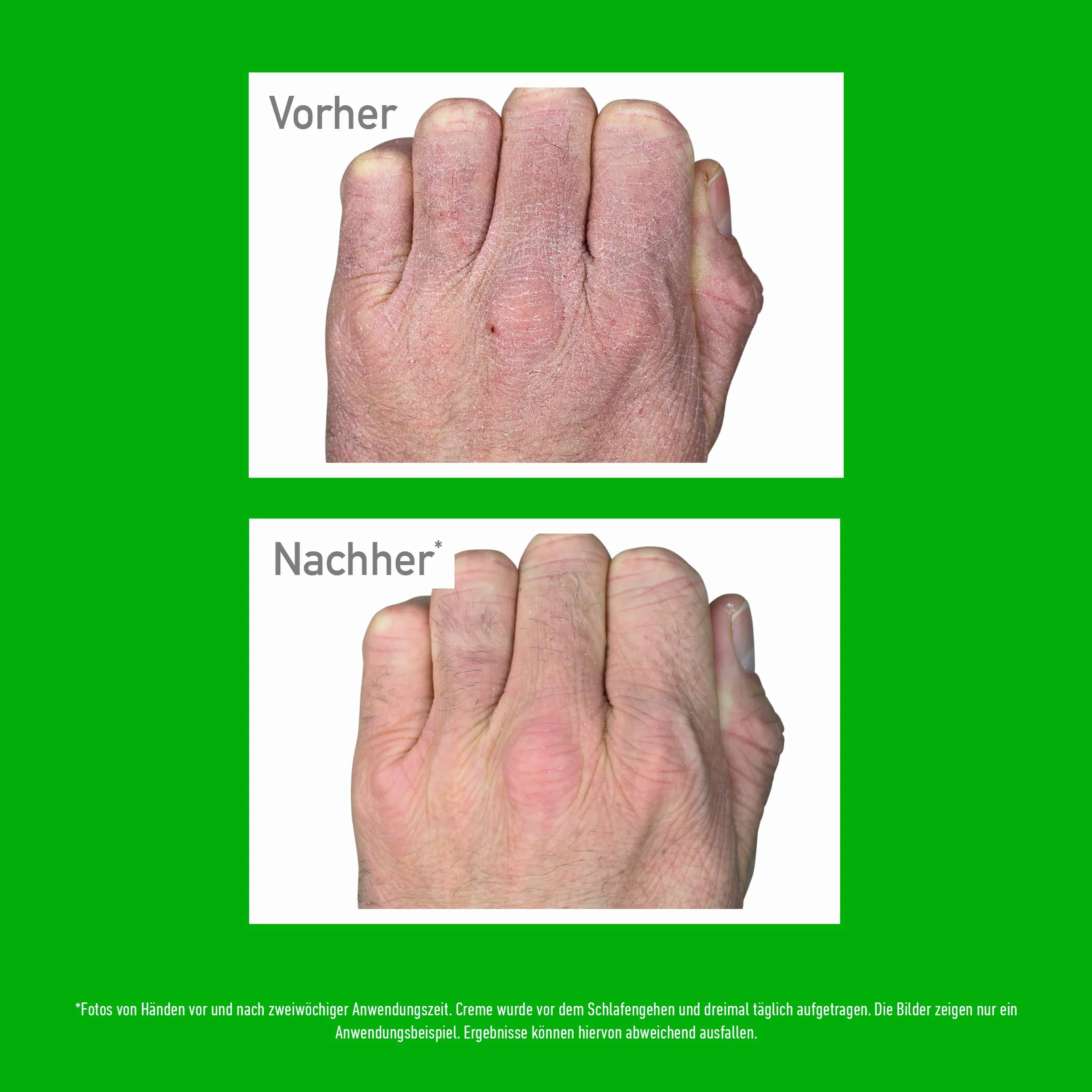 O'Keeffe's Working Hands tubka 80 ml, 2 sztuki – krem do rąk do ekstremalnie suchych, popękanych dłoni, błyskawicznie zwiększa nawilżenie, tworzy warstwę ochronną i zapobiega utracie wilgoci