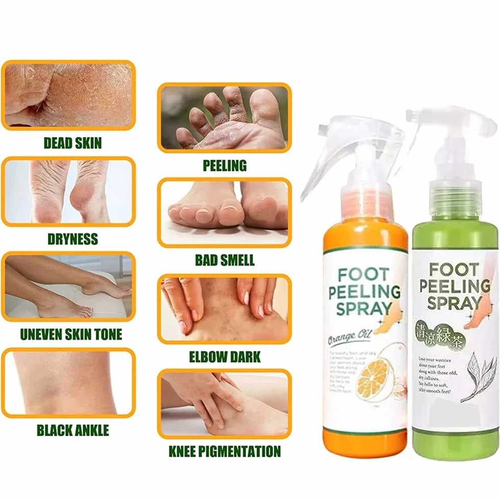 Foot Peel Spray,Foot Peeling Spray Orange Oil,Foot Peeling Spray That Remove Dead Skin,Hydrating Nourish Peel Off Spray,Quickly Remove Dead Skin and Calluses on Feet (Tangerine)