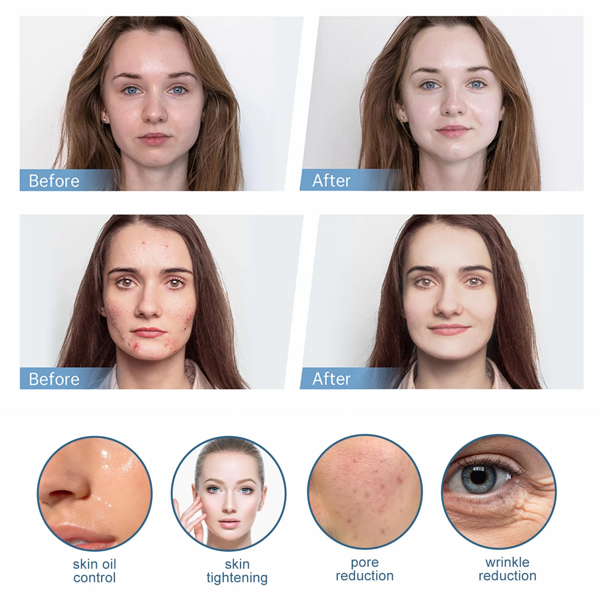 Nano-HS Nano-HS wymienne igły do pisaków mikroigłowych do aplikatora serum Hydra Pen H3 H5, autentyczne jednorazowe igły zastępcze, akcesoria do pielęgnacji skóry (Nano-HS, 15 szt.)