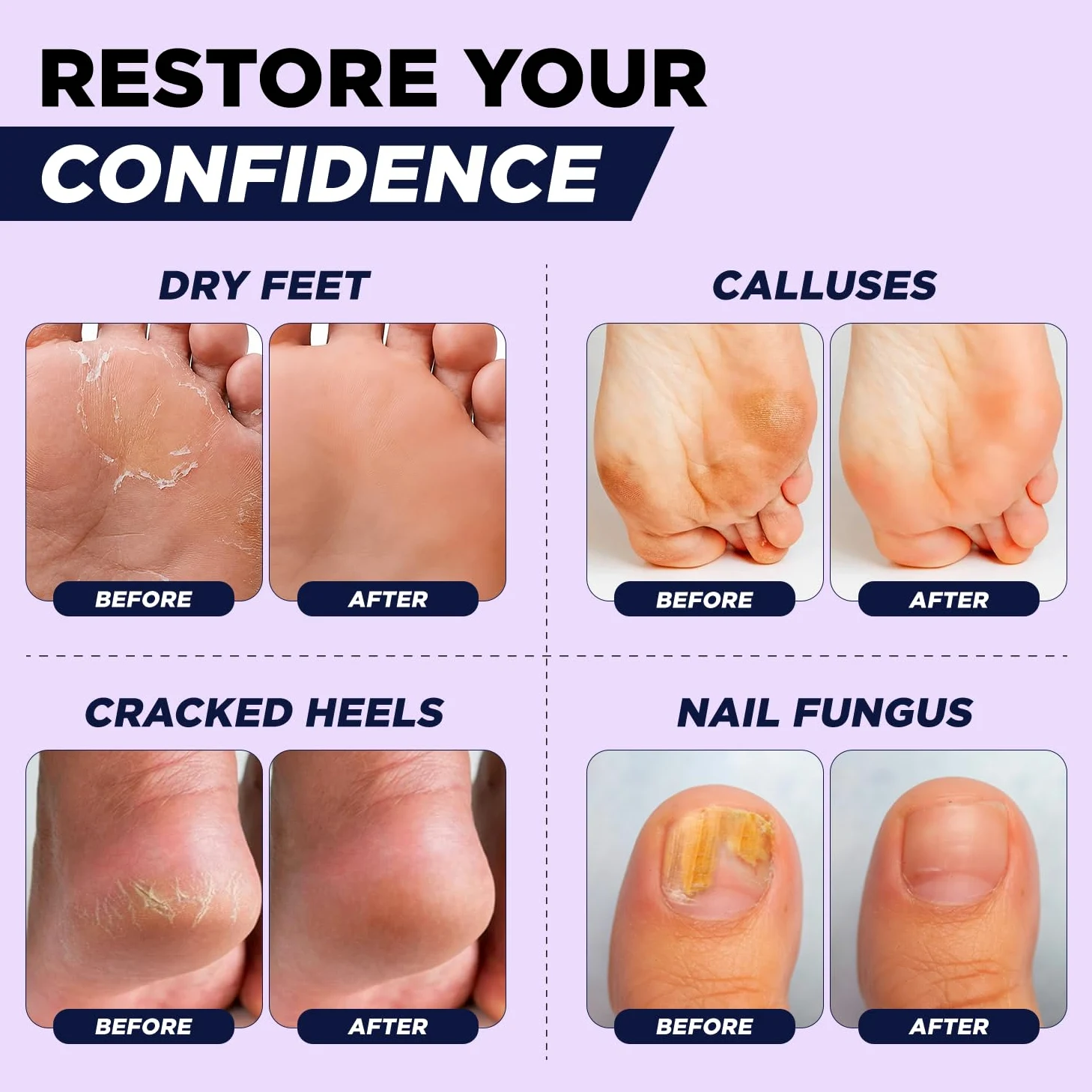 Soothing Lavender Foot Soak with Epsom Salt - Best Toenail Treatment & Softens Calluses - Soothes Sore & Tired Feet, Foot Odor Scent, Spa Pedicure - Wyprodukowano w USA - 2 sztuki