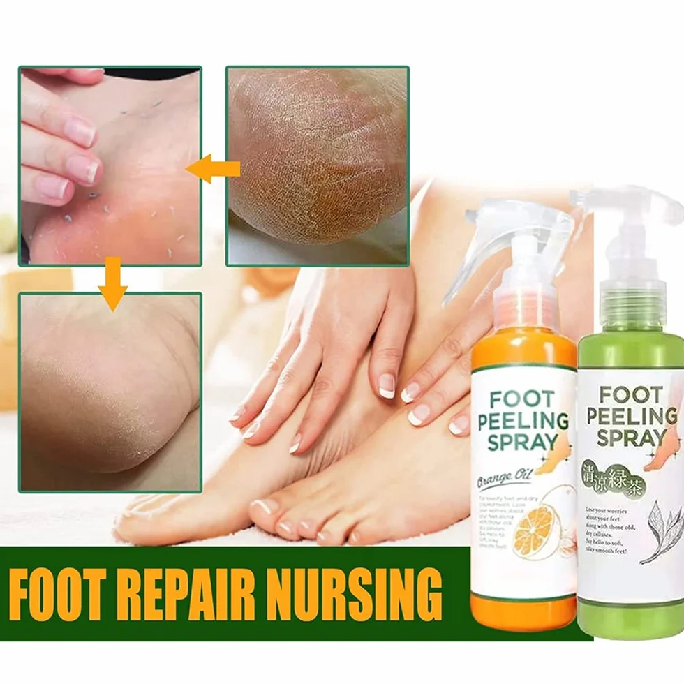 Foot Peel Spray,Foot Peeling Spray Orange Oil,Foot Peeling Spray That Remove Dead Skin,Hydrating Nourish Peel Off Spray,Quickly Remove Dead Skin and Calluses on Feet (Tangerine)