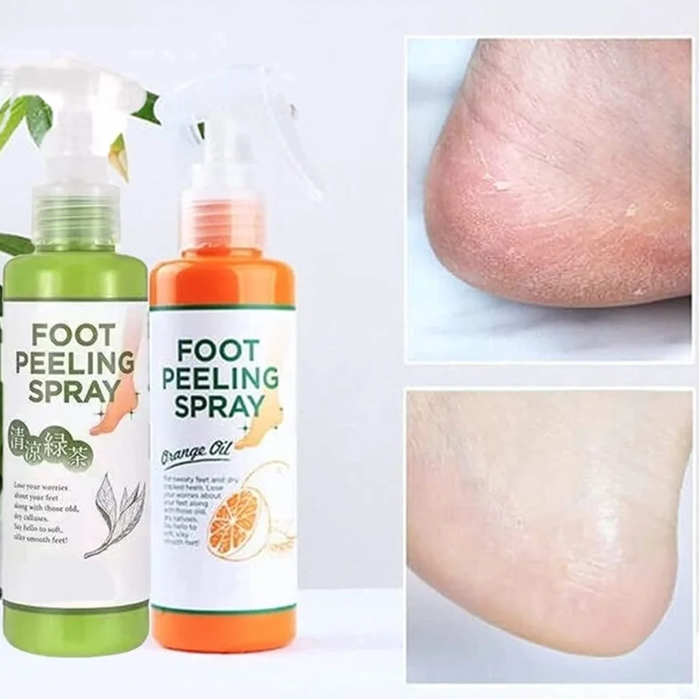 Foot Peel Spray,Foot Peeling Spray Orange Oil,Foot Peeling Spray That Remove Dead Skin,Hydrating Nourish Peel Off Spray,Quickly Remove Dead Skin and Calluses on Feet (Tangerine)
