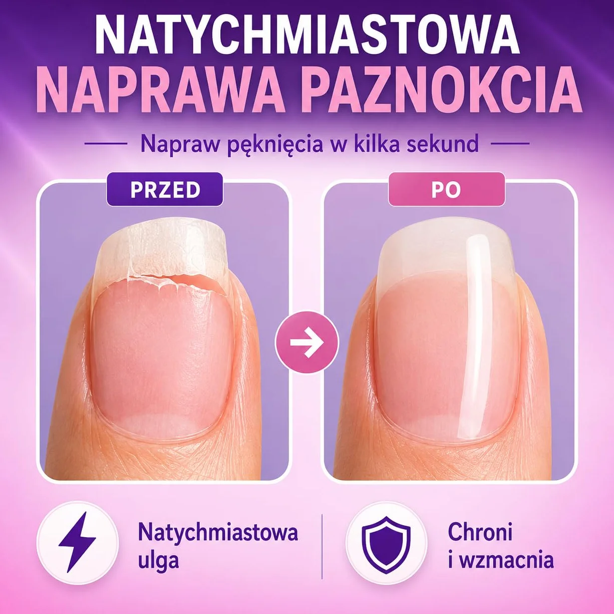 1 x 32 plastry do paznokci ~ Tymczasowa ochrona przed rozdwajaniem i pęknięciem paznokci Finga-Nails