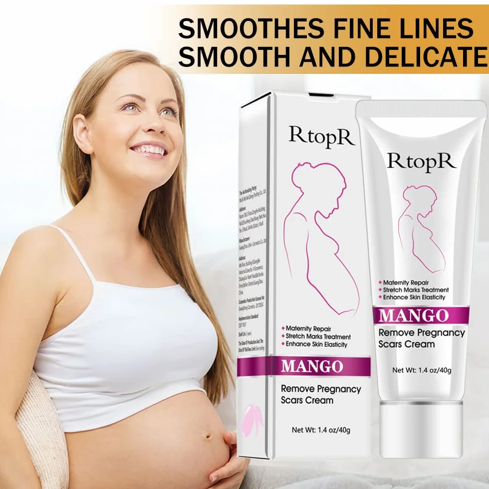 Krem na rozstępy, krem do usuwania blizn, krem do naprawy rozstępów, blizn ciążowych, krem Stretch Marks Cream, 40 g