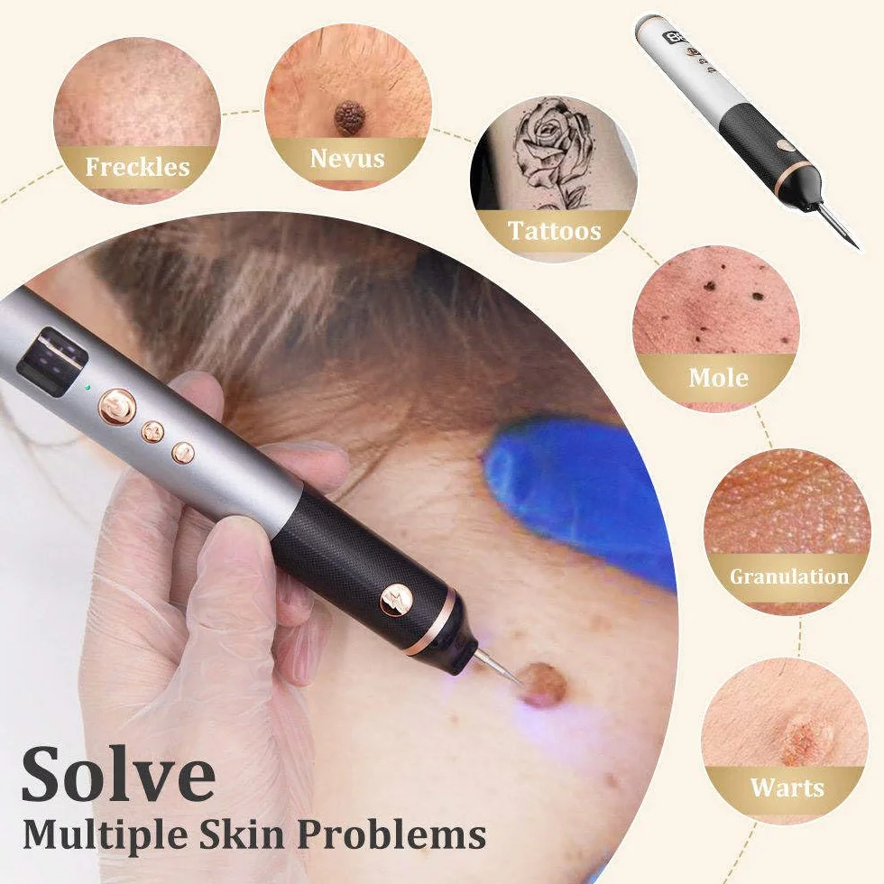 15-Poziomowy Laser Plazmowy Do Usuwania Narośli Skórnych, Brodawek, Pieprzyków, Plam, Piegów, Znamion, Ust, Dłoni, Oczu, Szyi, Twarzy, Głowy, Nosa, Bezpieczny I Bezbolesny, Nie Uszkadza Skóry