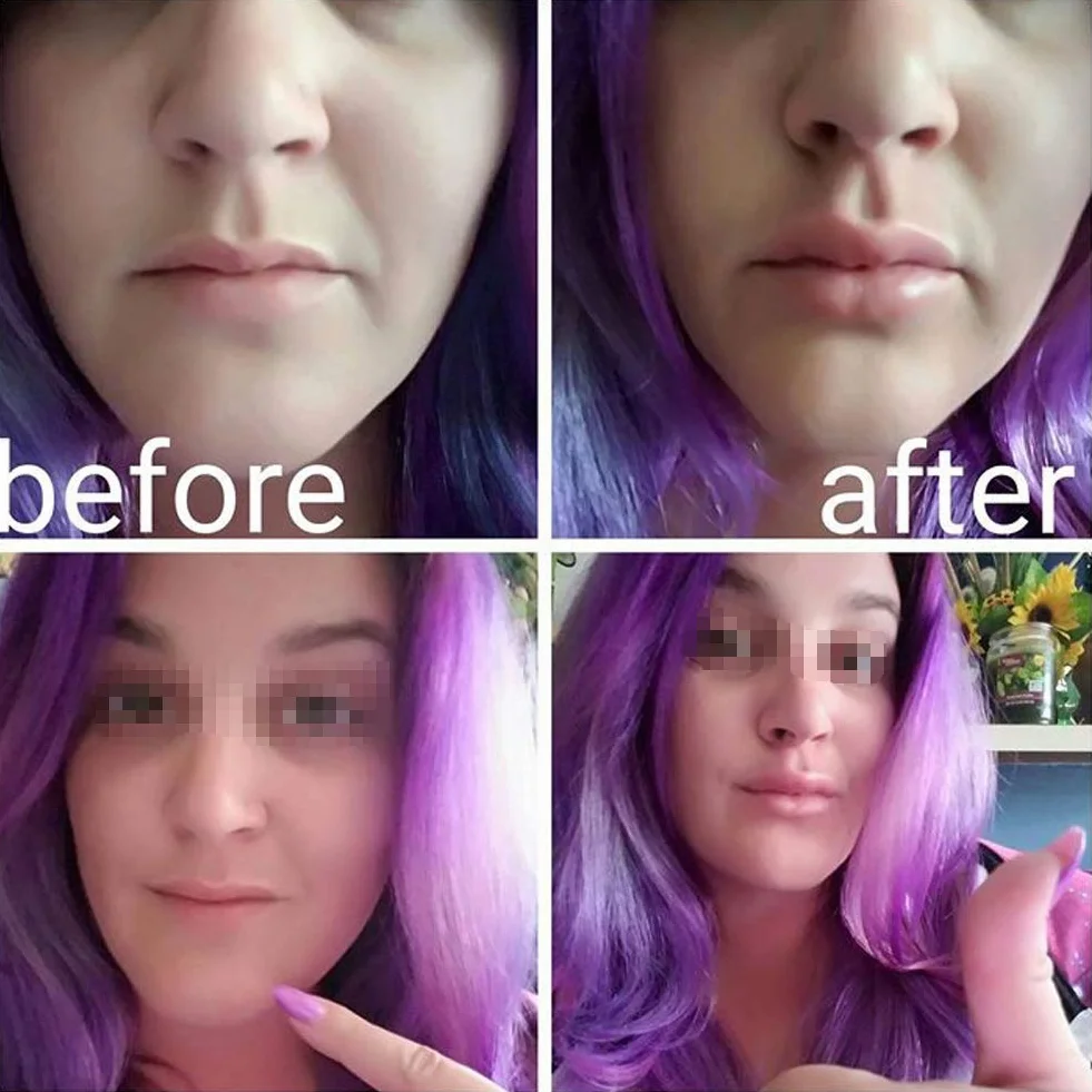 Uderzacz do ust, przenośny rozmiar w kształcie ryby plumper wzmacniacz poprawa opadających ust plumper ssanie, pełne odsysanie ust, silikonowy materiał dla kobiet makijaż