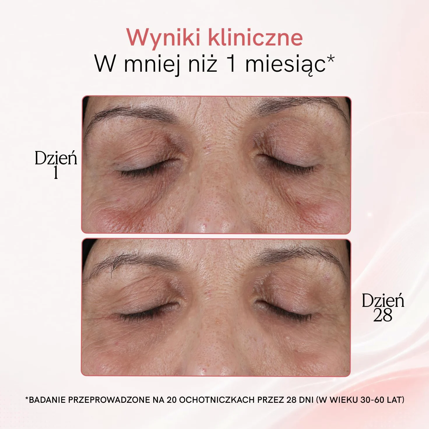 MASDERM | Urządzenie o częstotliwości radiowej 7 w 1 | Elektryczne urządzenie do masażu twarzy | Wiotczenie twarzy | Profesjonalna maszyna Hifu do twarzy i ciała | Wysoka częstotliwość Estetyczna |