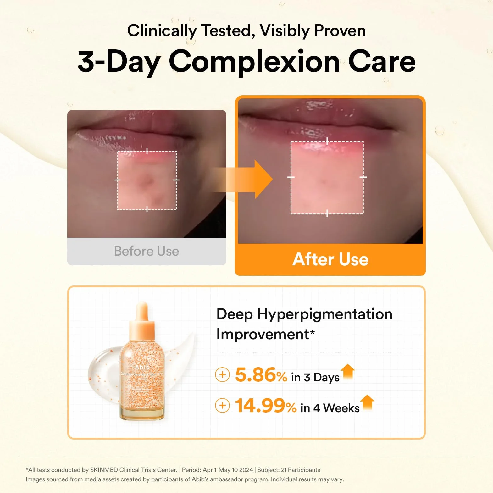 Abib Glutathiosom Dark Spot Serum Vita drop 50ml. | Koreańska skóra skóry, ciemne miejsce, leczenie przebarwień | Serum świecące dla wrażliwej skóry, niacynamid, Viatmin C
