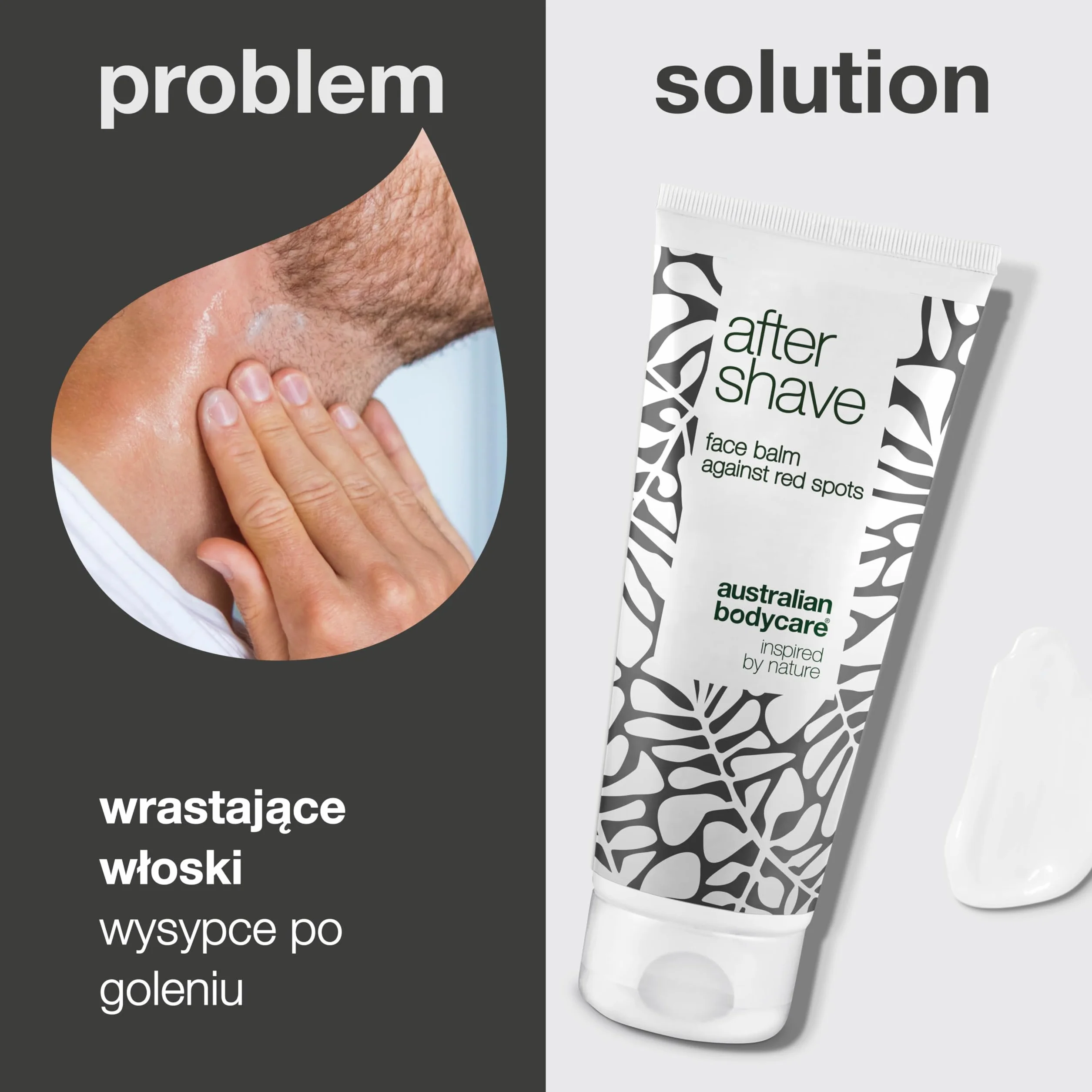 Australian Bodycare After Shave balsam dla mężczyzn, 100ml | Łagodzi podrażnienia i eliminuje zadrapania i czerwone plamy | zmniejsza wrastające włoski | Z 100% Olejkiem z Drzewa Herbacianego