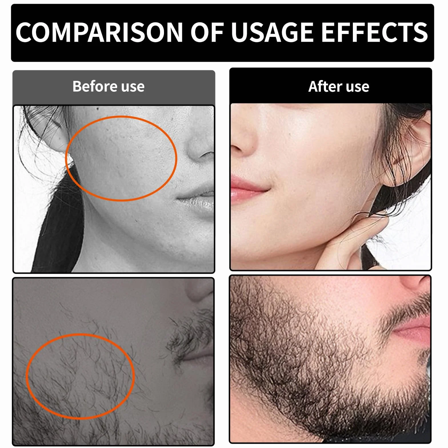 0,5 cm Mikroneedling do twarzy, Microneedling Hair z 540 końcówkami, mikroigłowa rolka do brody do twarzy, włosów, skóry, zmarszczek, wzrostu brody z mikroigłą do
