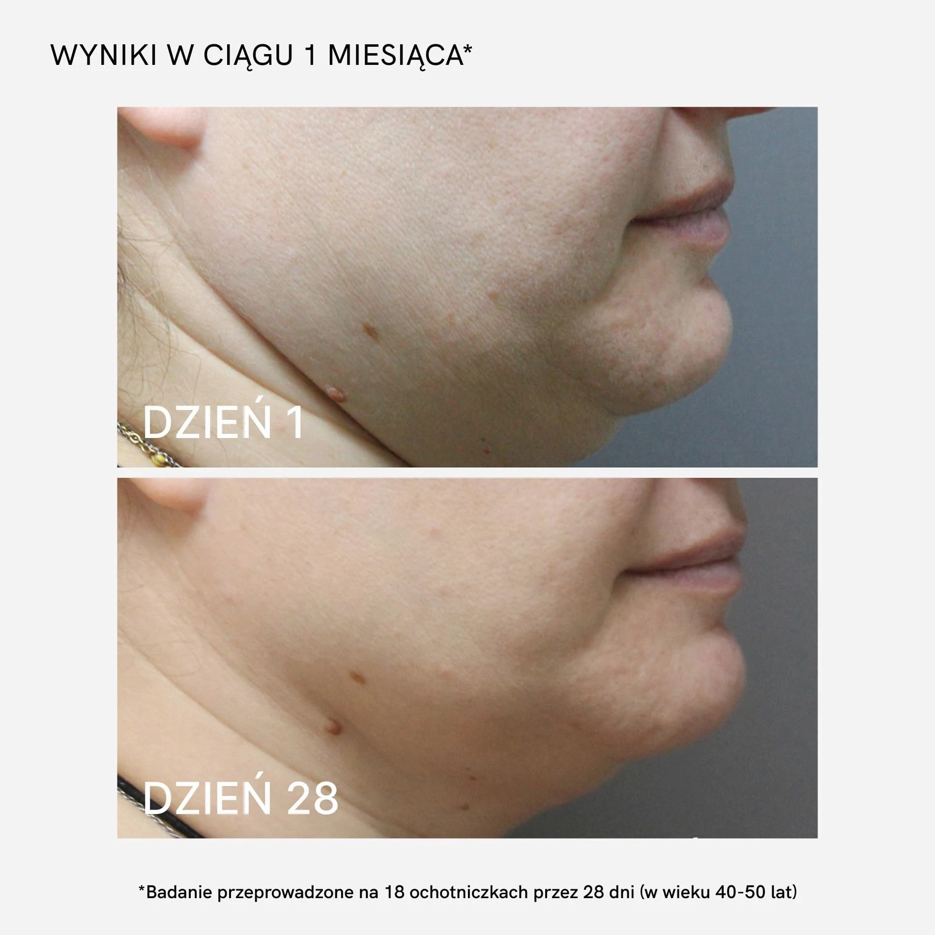 MASDERM | Zestaw masażera twarzy i szyi + nawilżający krem do twarzy o częstotliwości radiowej 500 ML | Ujędrniający przeciwzmarszczkowy | Masażer Galvanica Twarzy | Red Light Therapy Face |